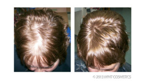 before-after-groei360-e1375108939648
